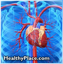 Potilaiden tunnistaminen ja hallinta, joilla on suuri sydämen rytmihäiriöiden riski modifioidun sähkökouristushoidon (ECT) aikana.